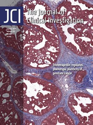 Targeted degradation of oncogenic KRAS<sup>G12V</sup> triggers antitumor immunity in lung cancer models