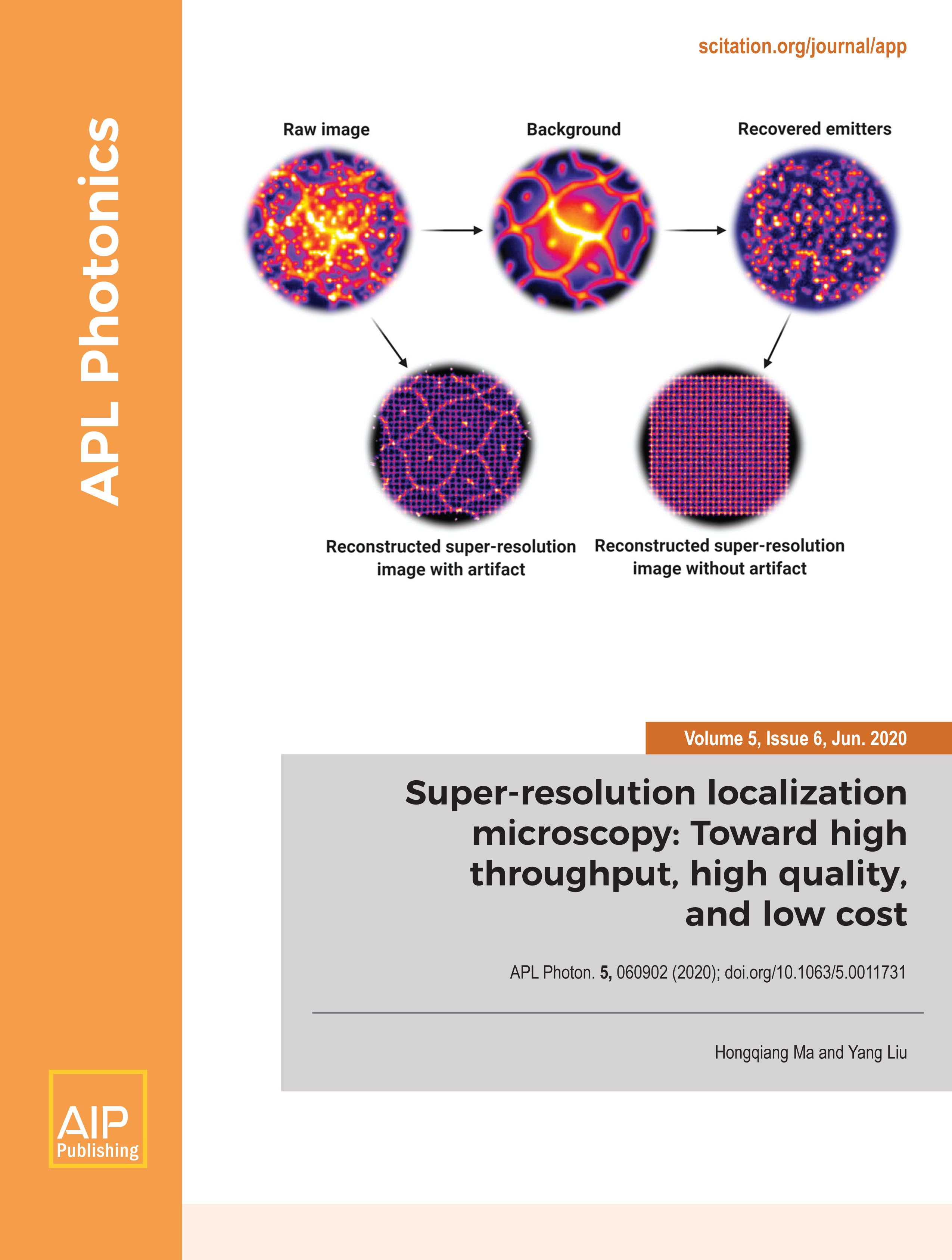 Super-resolution localization microscopy: Toward high throughput, high quality, and low cost